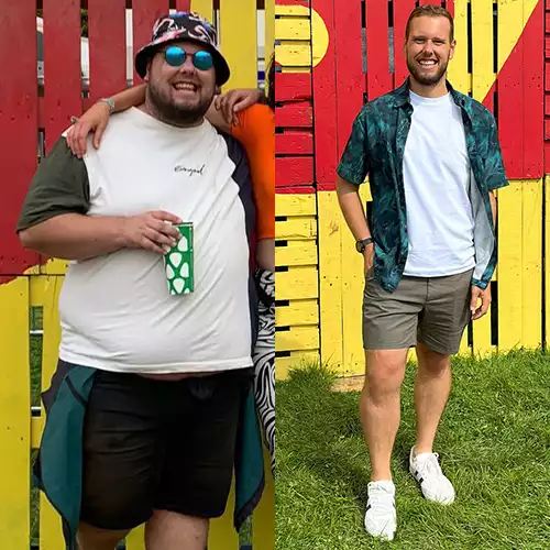 Before and after weight loss transformation showing a young man with higher body weight compared to a slimmer post-results appearance