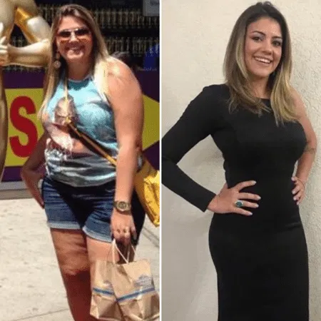 Before and after weight loss transformation showing a young woman with higher body weight compared to a slimmer post-results appearance