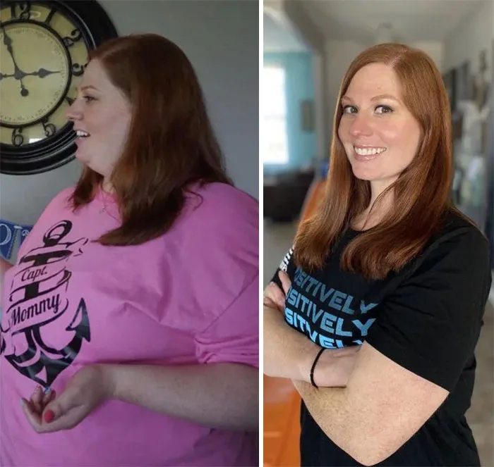 Before and after weight loss transformation showing a woman with higher body weight compared to a slimmer post-results appearance